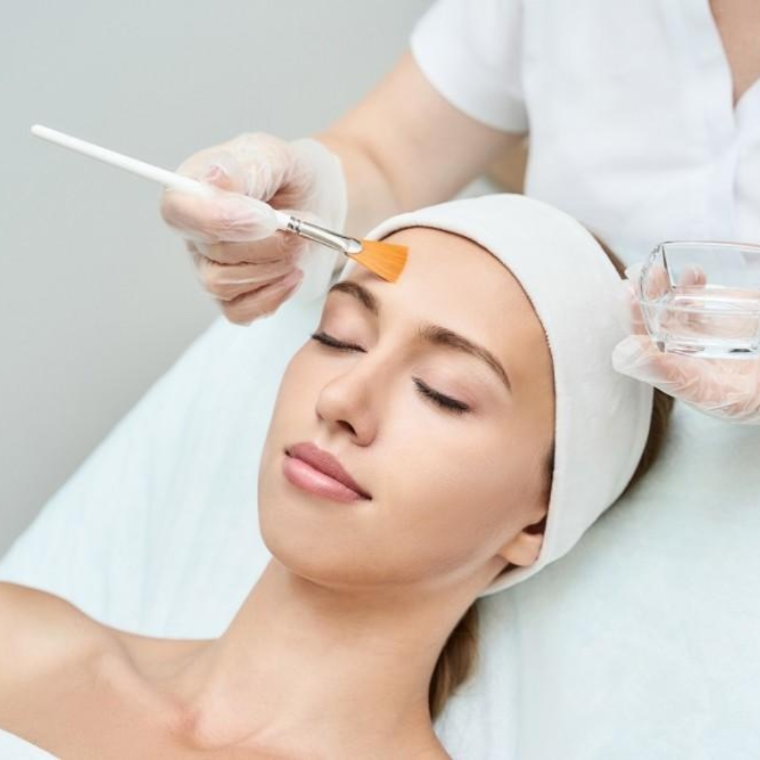 Mild Acid Peel